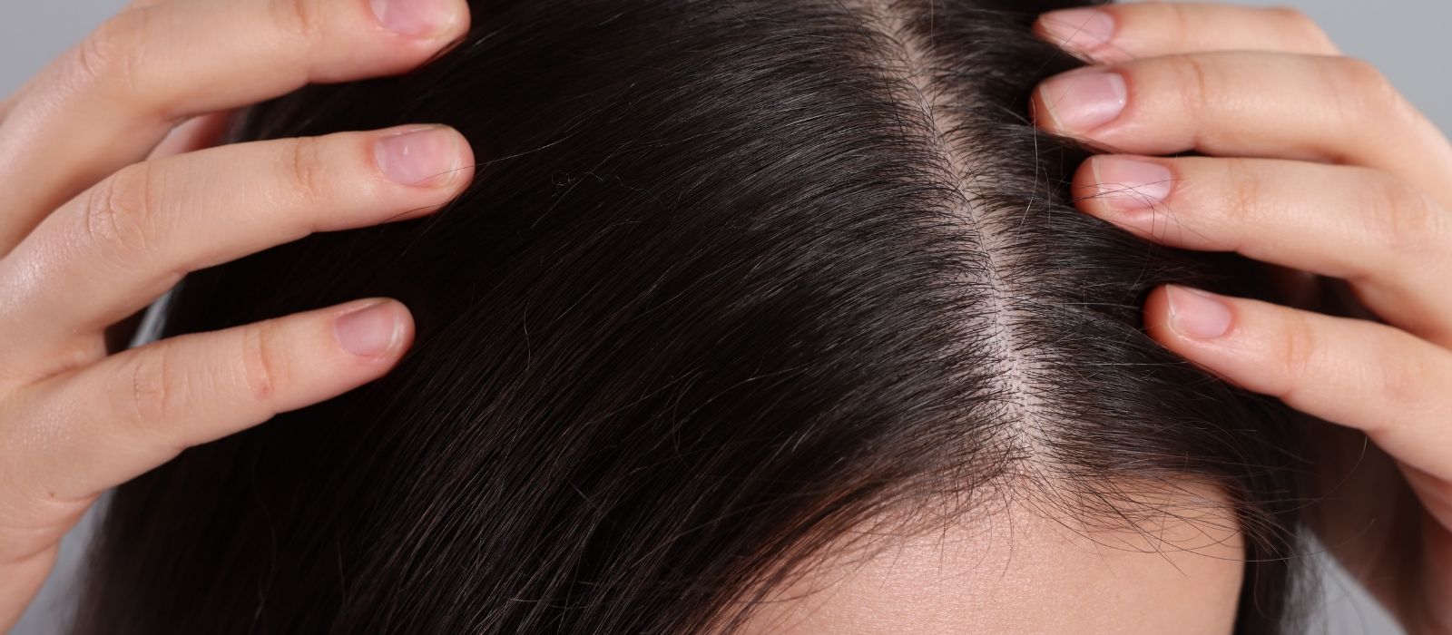 How to Tell If You Have Dry Scalp vs Dandruff (And What Actually Works for Each)