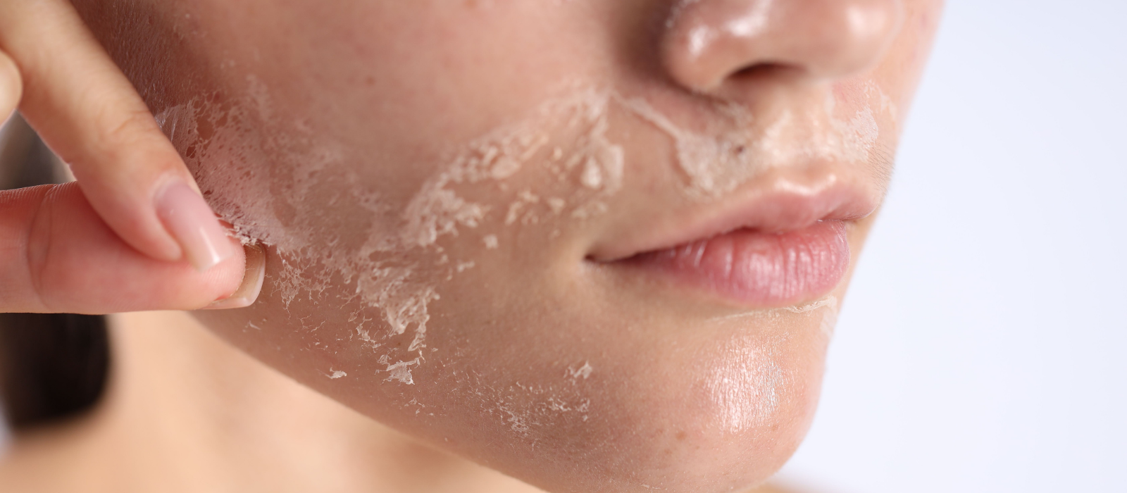 how to tell if you have sensitive skin and what to do about it
