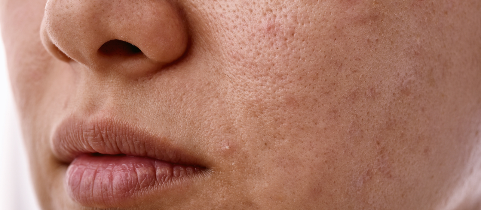 what are these bumps on my face how to identify and treat them