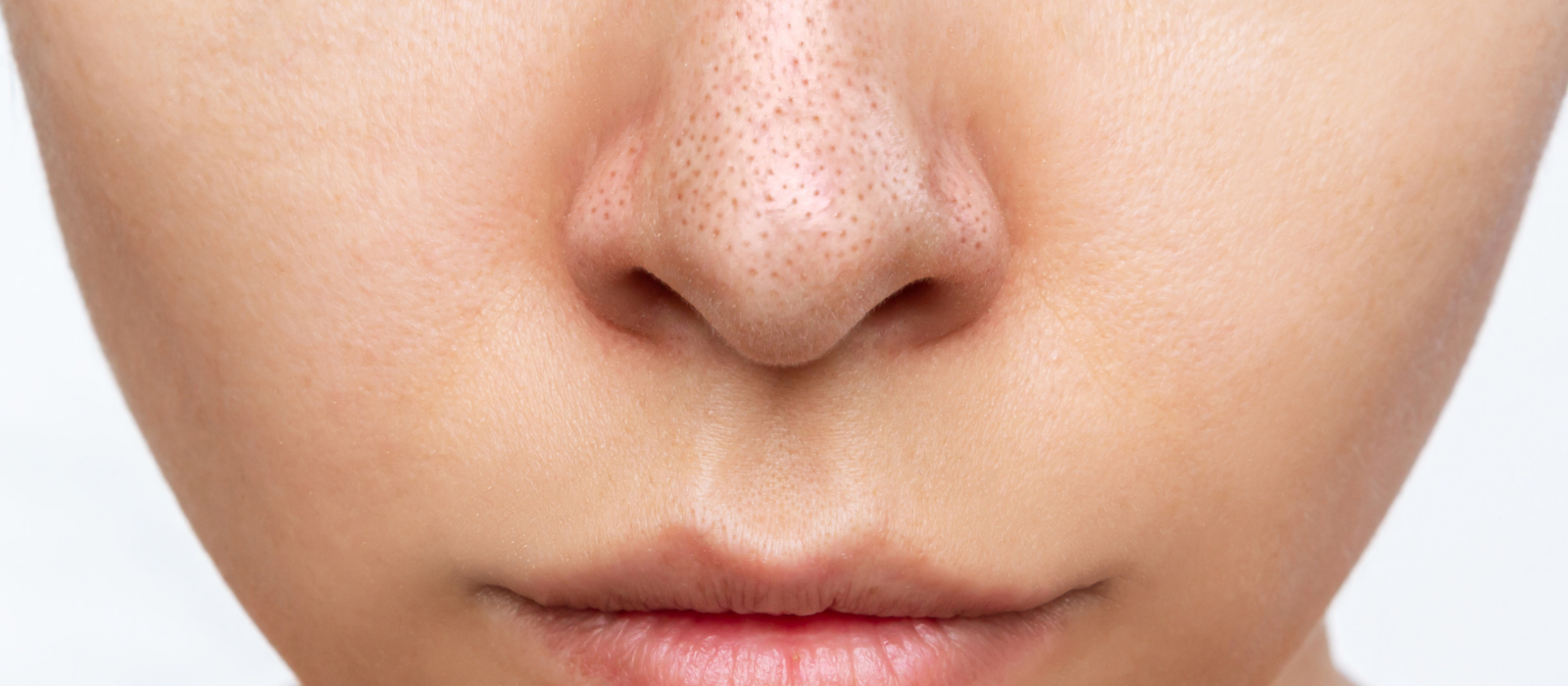 what are those gray dots on my nose sebaceous filaments vs blackheads