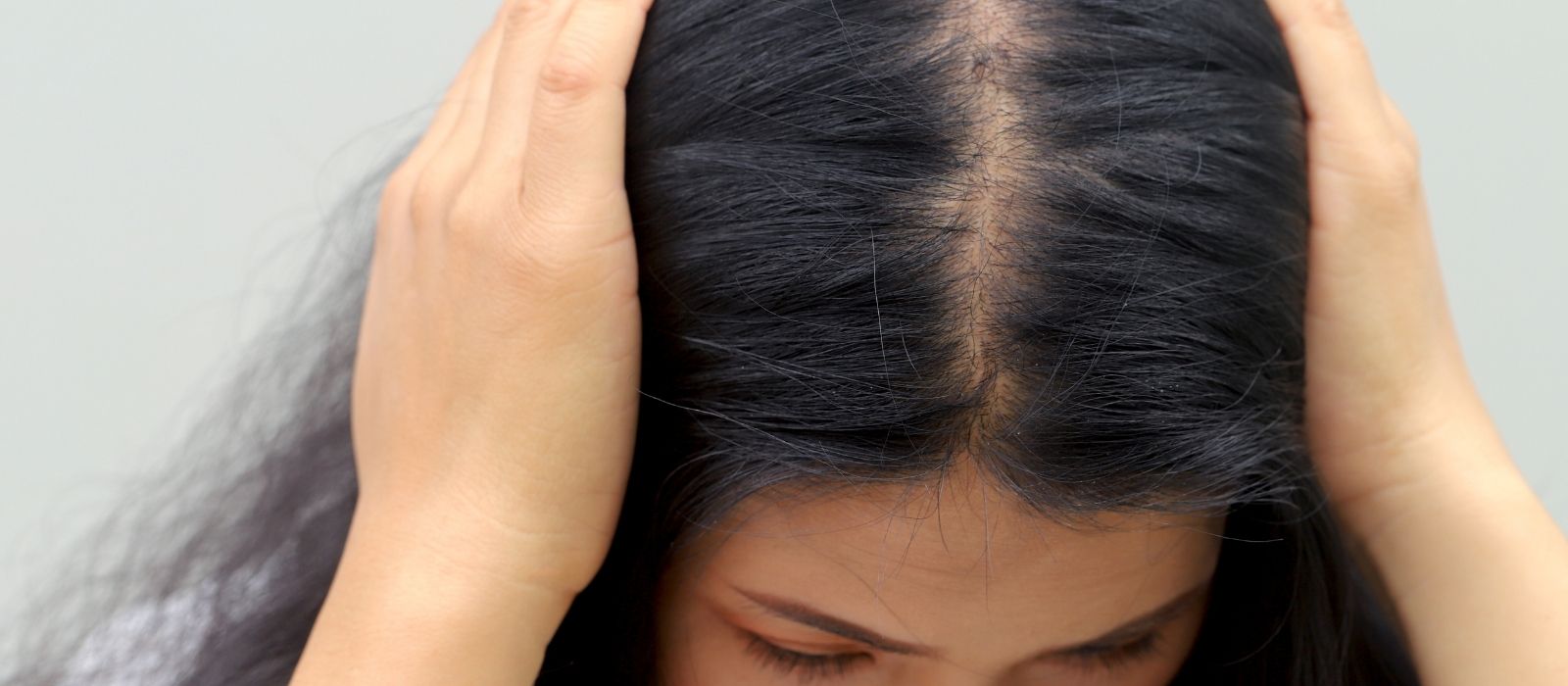 why-is-my-hair-thinning-hormonal-hair-loss-women-causes-treatments