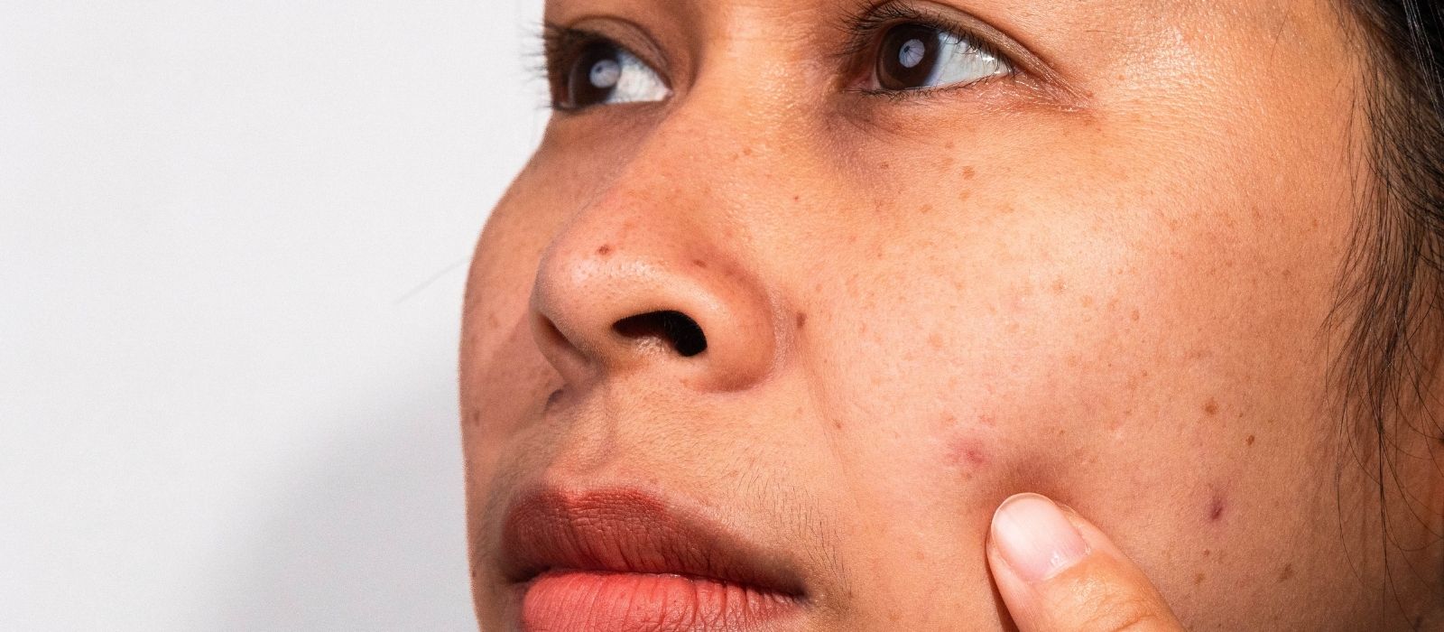 Why Is My Skin Tone So Uneven and What Actually Fixes It on Dark Skin